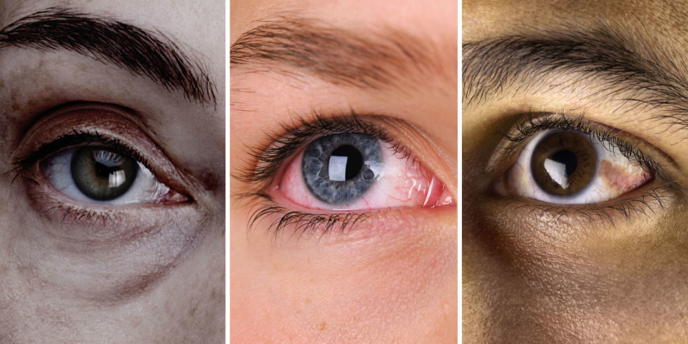 1490364306-landscape-1490309105-eyes-health