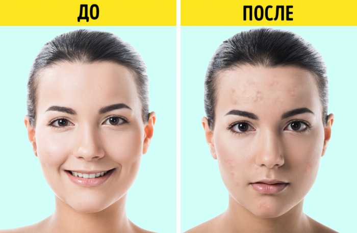 7 косметических продуктов, которые попали в черный список дерматологов