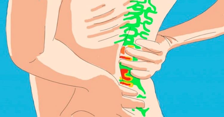 Как вылечить межпозвоночную грыжу без скальпеля: операция больше не нужна!